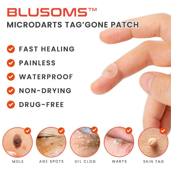 Skin Tag Remover Patches (144 Pcs)